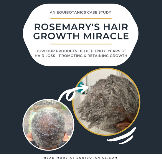 Case Study: Rosemary's Hair Growth Miracle