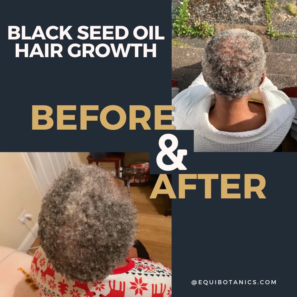 Black Seed Oil Hair Growth Before And After