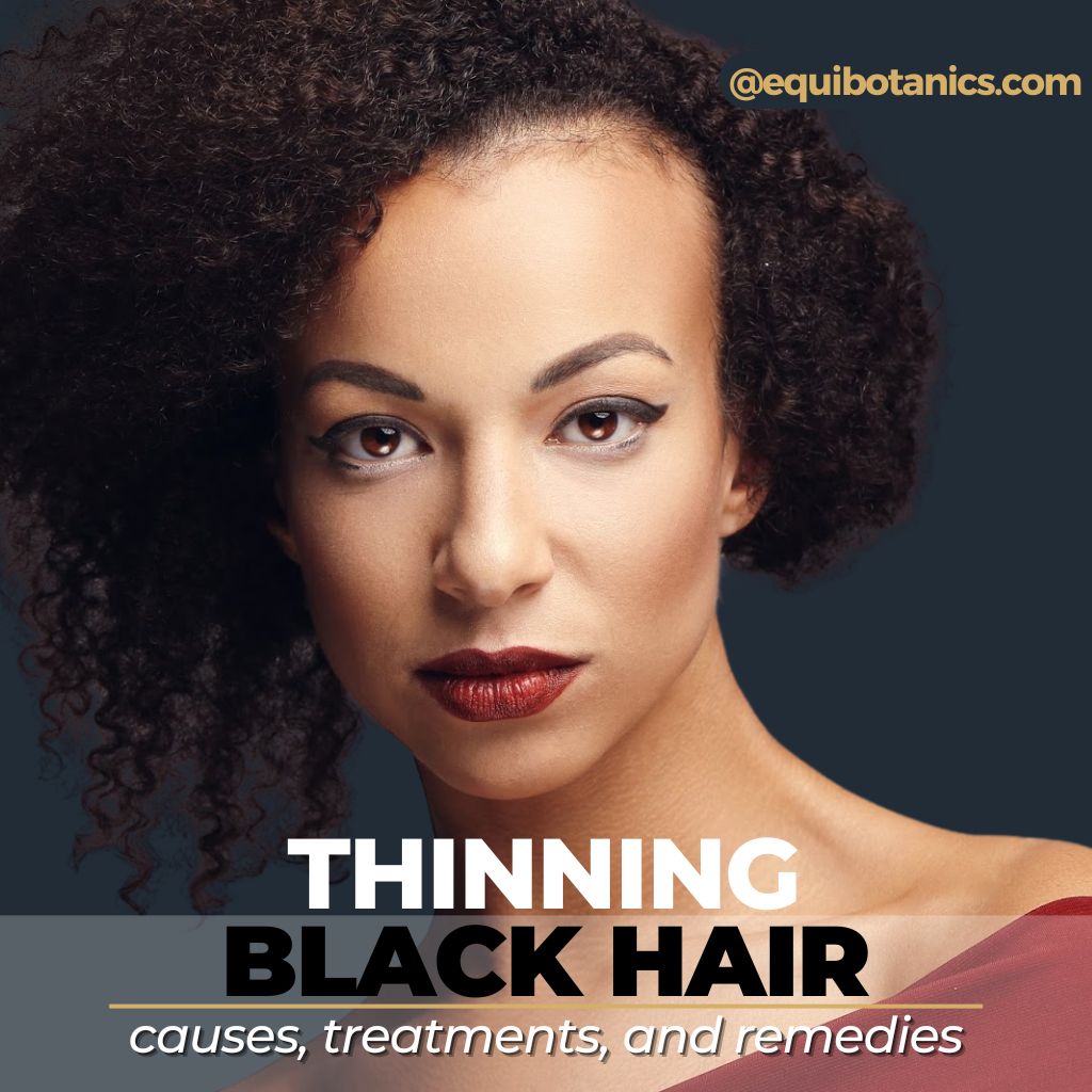 Thinning Black Hair | Causes, Treatments and Remedies