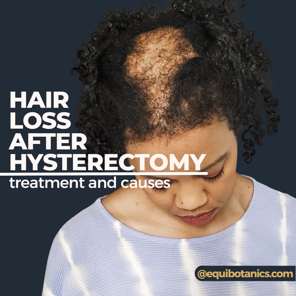 hair loss after hysterectomy