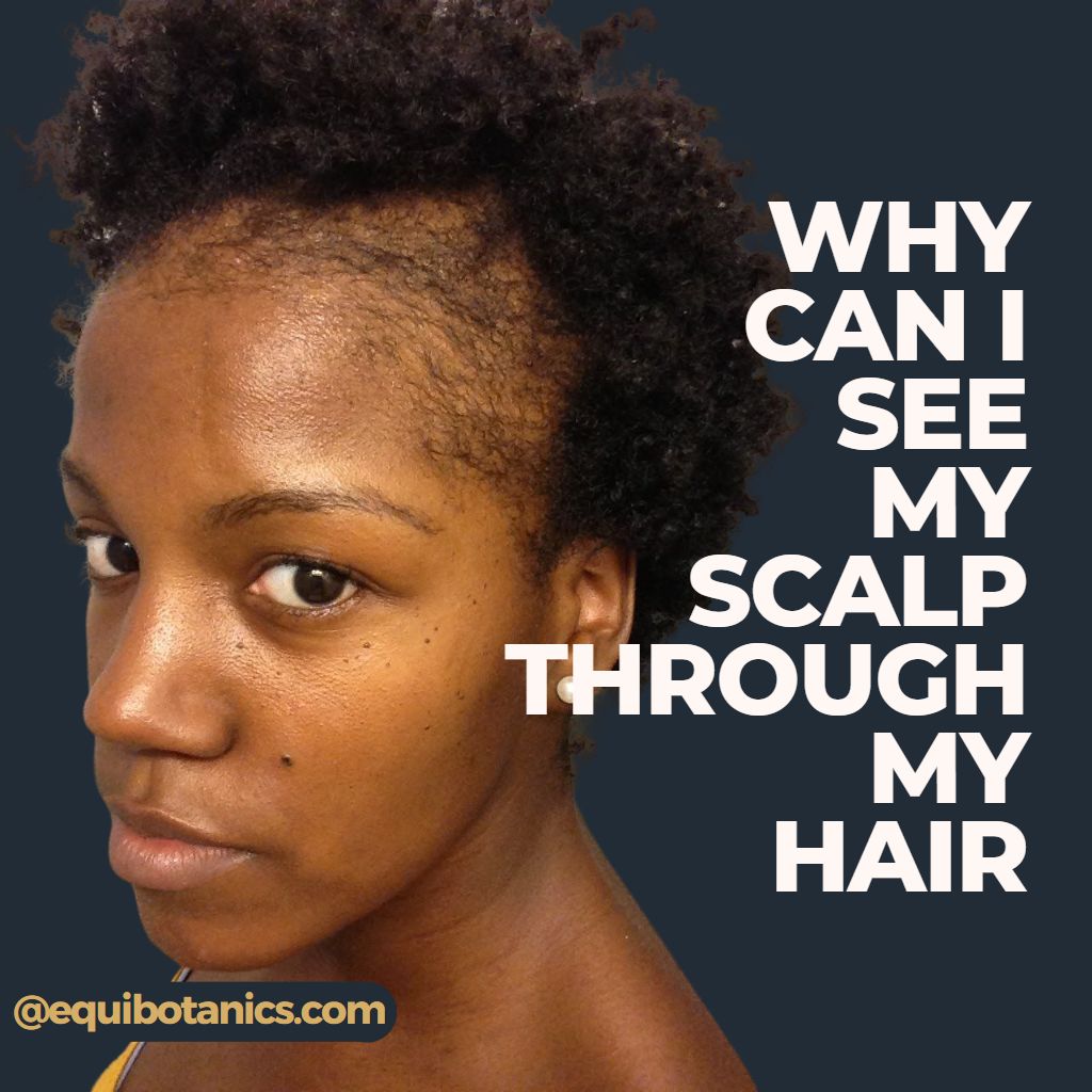 My hair is so thin I can see my scalp! Expert Advice & Reasons
